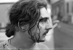 "AJZ-Schliessung" - Von Gummigeschoss am Kopf verletzter Jugendlicher, 04.09.1980